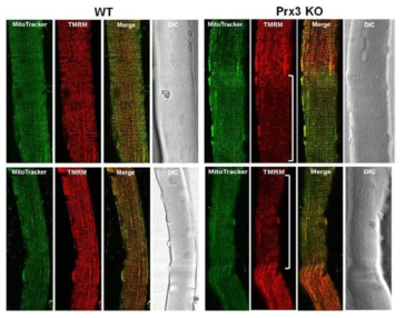 Prx3 KO FDB muscle fiber의 감소된 미토콘드리아 활성도