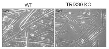 TRIX30-/- primary myoblast cell 에서의 분화 저해