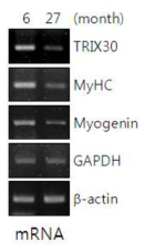 heart, skeletal muscle에서 노화에 따른 TRIX30 유전자의 발현 정도