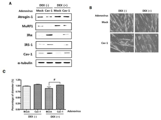 DEX와 caveolin-1 처리 전 후의 근감소증 마커의 발현 및 근섬유 지름의 변화
