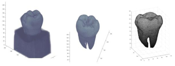 제작된 치아모델의 3차원 재구성영상(오른쪽)과 영상분할기법으로 치아만 선택된 화면(중간). 딜라우니 삼각법을 적용하여 치아의 유한요소화한 결과(오른쪽)
