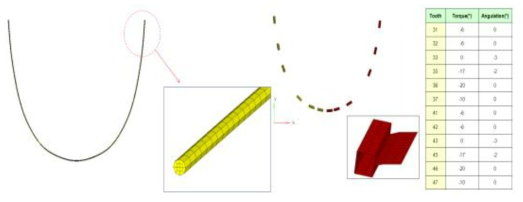 부정교합 class II 환자의 하악을 위한 와이어와 브라켓(torque와 angulation 정보)의 FEA 모델.