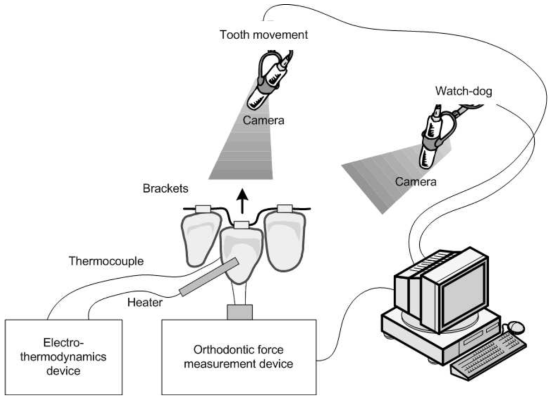 타이포돈트 시스템을 이용한 치아이동 실험장치