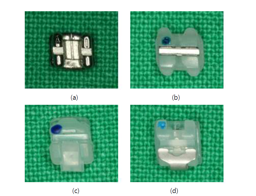 4종류의 교정용 브라켓