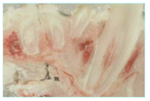 Compression side osteoclast bone resorption과 tension side osteoblast bone formation