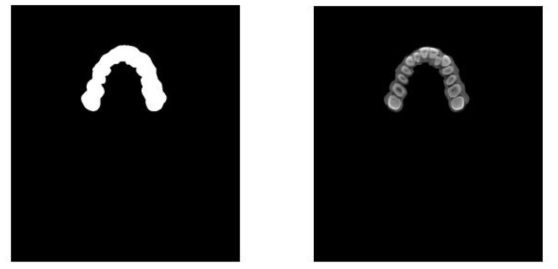 Dilated 이미지(좌)와 치아만을 추출한 이미지(우)