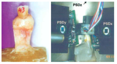 (좌) 실험에 사용된 레진에 block된 lower right canine 샘플, (우) 비침습적으로 측정하는 실험 장면; 측정은 3개의 position sensitive devices (PSD)가 마운트된 Mobility Measurement System (MOMS)가 사용됨