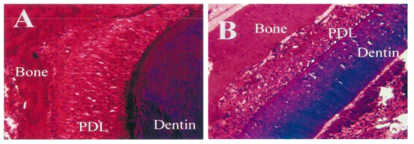 Female mandible control and experimental samples (200×). (A) Control (B) Experimental sample treated with 500ng/ml od relaxin