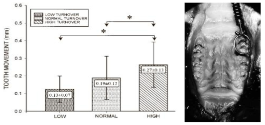 (좌)Tooth movement의 평균값과 표준편차. (우)High turnover rat에서 치료말기 orthodontic appliance
