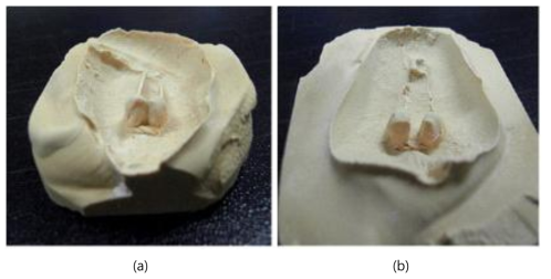 Rat를 이용한 치아 이동의 in vivo 실험으로 얻은 석고틀. (a) 치아 이동전과 (b) 치아 이동 후.
