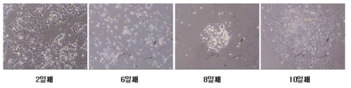Electroporation G418 selection에 의해 나타나는 KTPU8 세포의 모양