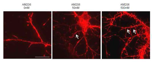 알츠하이머 신약 치료제를 이용하여 알츠하이머 뉴론에서 synaptogenesis 를 성공한 모습