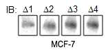 tamoxifen 타깃들의 MCF-7 세포주에서 단백질 발현 확인