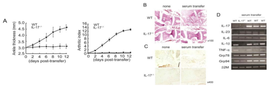 IL-17 is indispensable for developing autoantibody- induced arthritis.