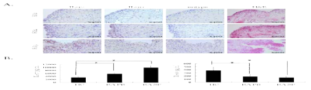 comparison of IL-17 and IL-10 expression in RA patients