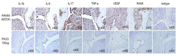 관절염 생체모델에서 PIAS3 처리에 따른 관절내 염증성사이토카인, 신생혈관인자, 관절파괴 인자 억제효과 관찰