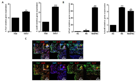 자가면역 관절염 Th17 세포에서 Fra-1, JunB complex의 발현