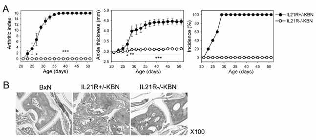 No arthritis development in IL-21R-/- K/BxN mice.