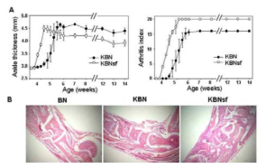 More severe arthritis in K/BxNsf mice.