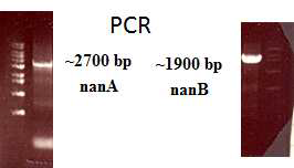 NanA, NanB PCR 증폭