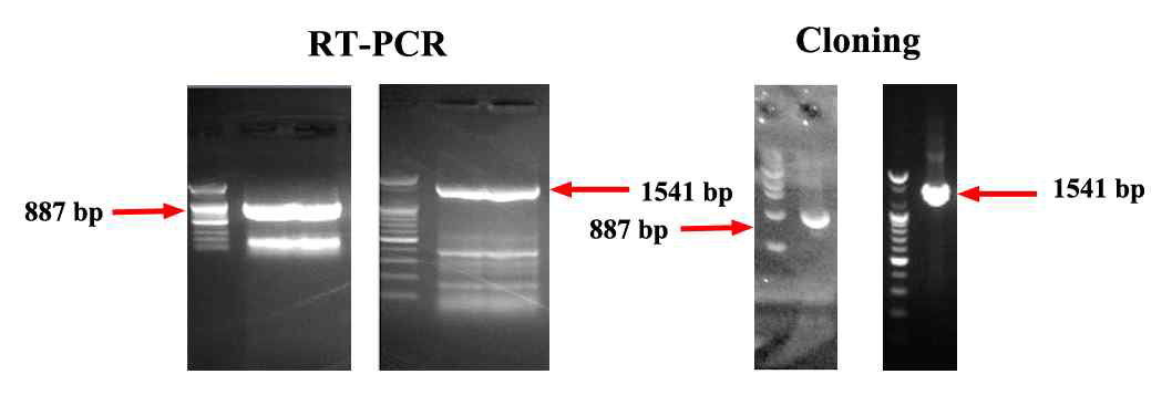 G9P[7] type 돼지로타바이러스의 VP4 유전자 증폭 전기영동 사진