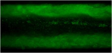 대장균 O157 (pGFP)가 칩 내의 벽면에 농축된 모습을 나타내는 형광 현미경 사진