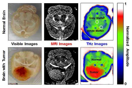 Comparison between MRI and THz images for human brain.