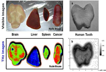 THz images of internal organs.