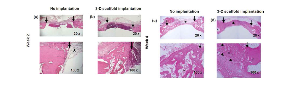 Microscopic observation of the H and E stained tissue sections of rabbit calvarial defects retrieved 2 weeks (a and b) and 4 weeks (c and d) after implantation; (a and c): no implantation as negative control; (b and d): treatment with electrospun 3D microfibrous scaffolds implant.