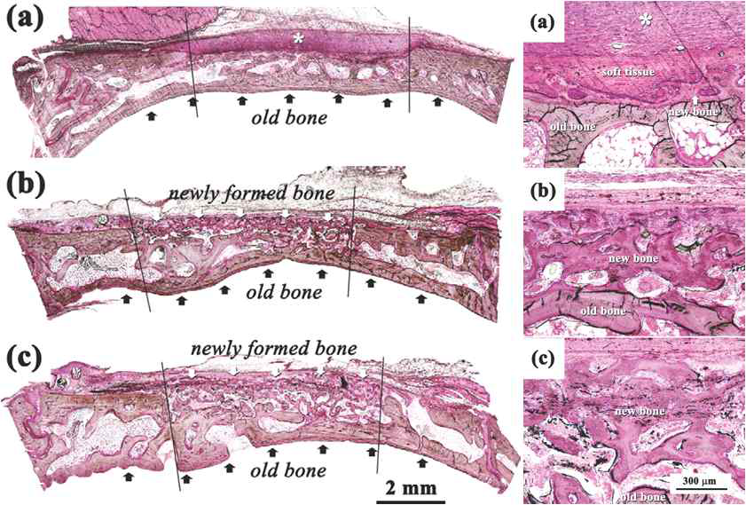 Optical micrographs of specimens a) PCL fiber, b) CaO-SiO2fiber, c) PCL/CaO-SiO2 fiber after 2 weeks of implantation into calvarial defects of New Zealand white rabbits. New and old bone tissues are denoted by white and black arrows, respectively
