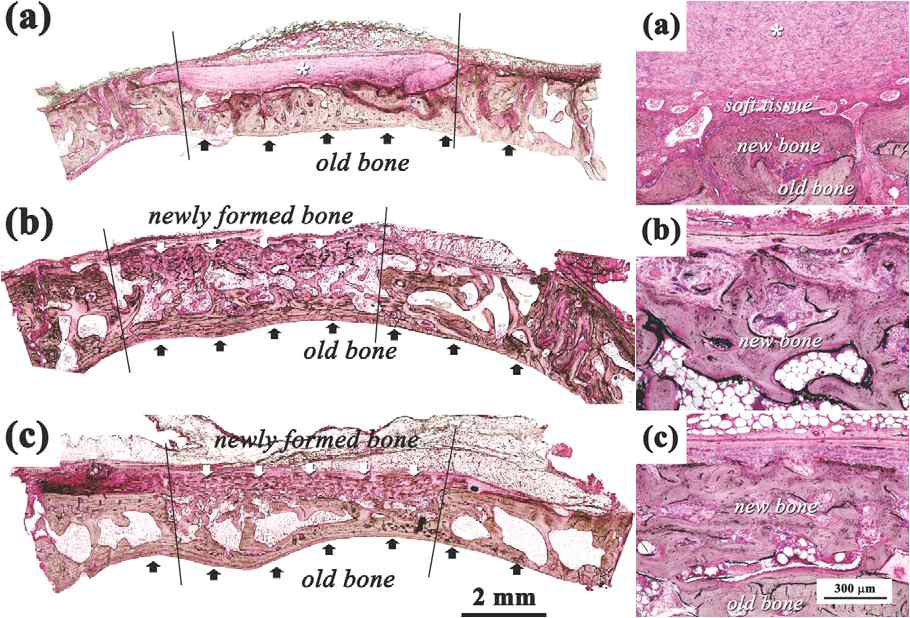 Optical micrographs of specimens a) PCL fiber, b) CaO-SiO2fiber, c) PCL/CaO-SiO2 fiber after 4 weeks of implantation into calvarial defects of New Zealand white rabbits. New and old bone tissues are denoted by white and black arrows, respectively.