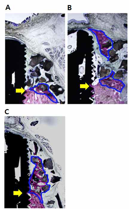 Representative histological image of implant grafted with hydroxy apaptite (HA) mixed with (A) collagen gel, (B) Collagen gel/BMP-2, (C) Collagen gel/BMP-2/PDGF-BB at 12 weeks. Blue line indicates new bone area