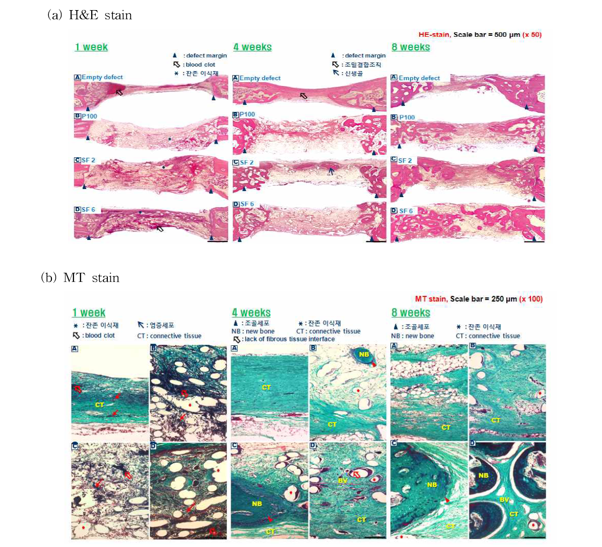 다양한 조성으로 제조된 SF/PCL 나노/마이크로 복합체의 골재생능 평가 (a) H&E stain and (b) MT stain of implanted SF/PCL scaffolds during 8 weeks.