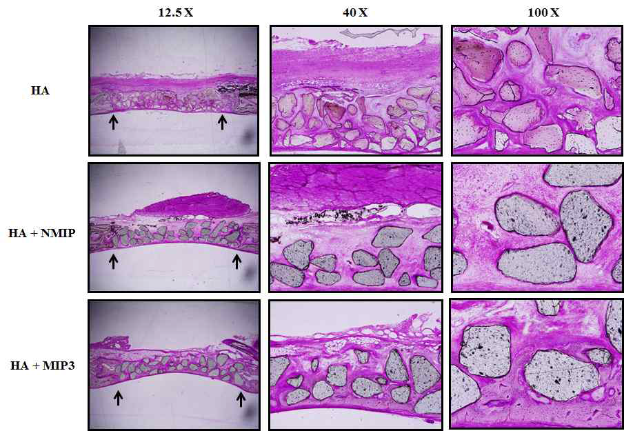 In vivo에서의 bone mineral과 MIP3의 골형성능 확인
