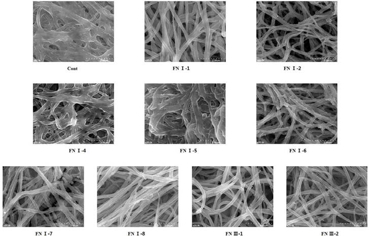 전자현미경으로 관찰한 피브린 수화젤의 구조