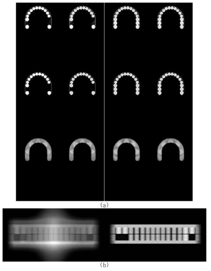 (a)는 압축센싱 기반으로 재구성된 영상에서 치아부분만 PT 영상화 하기 위해 재설정한 영역의 영상, (b) 이를 이용하여 PT 영상재구성한 결과