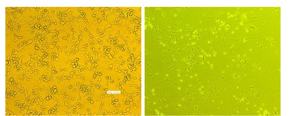 계대배양 시작 직후 종양 내 다양한 세포들이 집합 된 결과 (왼쪽)와 장기간에 걸친 계대 배양을 통해 종양세포만 특이적으로 배양 된 결과 (오른쪽).