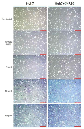 Recombinant CXCL12의 농도 의존적 Huh7의 침윤 정도 분석