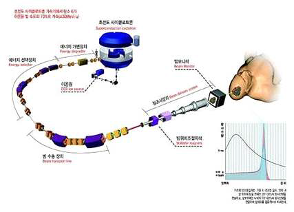 사이클로트론 치료 개념도