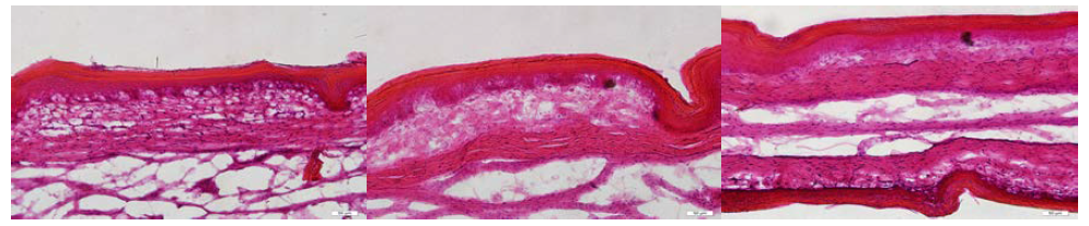 주령별(왼쪽부터 각 1, 2, 3주령) 오리 물갈퀴 부위 피부조직의 동결 절편 사진