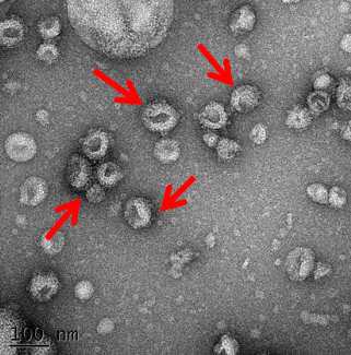 전자현미경으로 확인한 Clade 2 HPAI H5N1 VLP