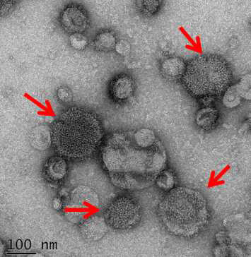 전자현미경으로 확인한 Clade 1+2 (동시발현) HPAI H5N1 VLP