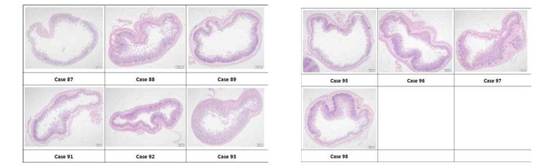 HPMCP(aP2)_Oral 조직 소견 (A) HPMCP(aP2)_Oral 조직 소견 (B)