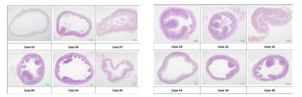 HPMCP(aP2)+LL RANKL_(Oral) 조직 소견