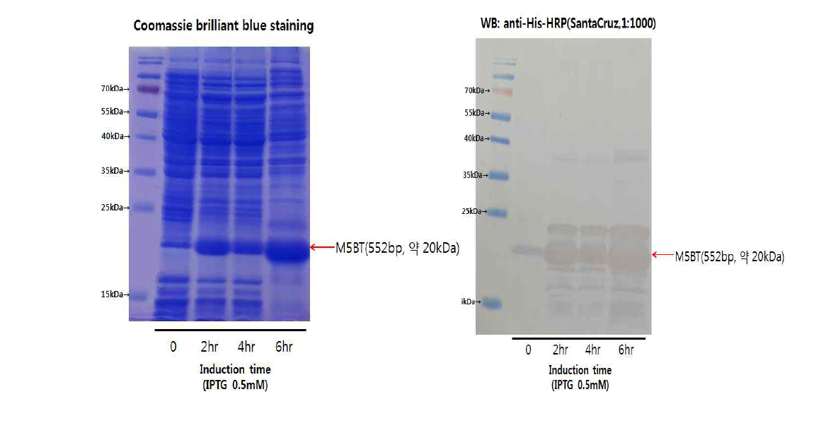 M5BT 단백질 별현 SDS-PAGE & western blot assay