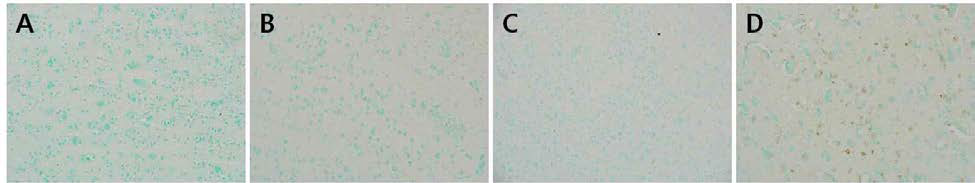 H5N1 공격 접종 후 뇌의 면역조직화학염색 결과.