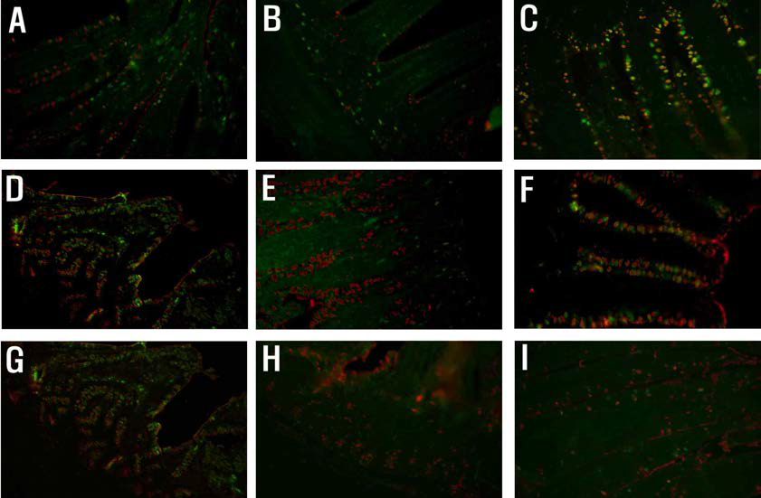 소장(A-C), 대장(D-F), 맹장편도(G-I)에서 조류 인플루엔자 수용체(green)와 인플루엔 자 바이러스(red)의 이중 형광 염색 결과