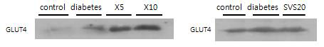 The relative GLUT4 expression in muscle