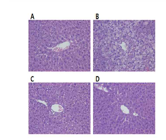 Effect of D-xylose on histopathology in mouse livers.