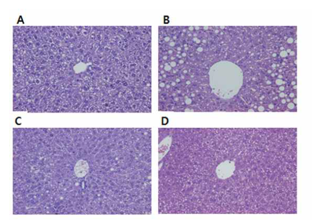 Histopathologically changed feature by stevioside in mouse livers